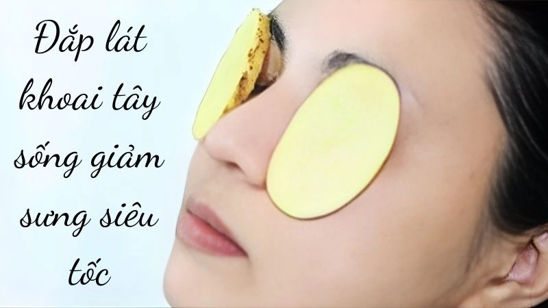 Đắp lát khoai tây sống giảm sưng siêu tốc