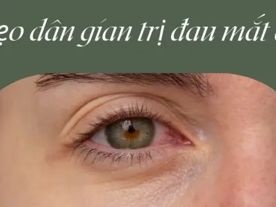 Mẹo dân gian trị đau mắt đỏ giảm sưng rát chỉ sau 1 ngày